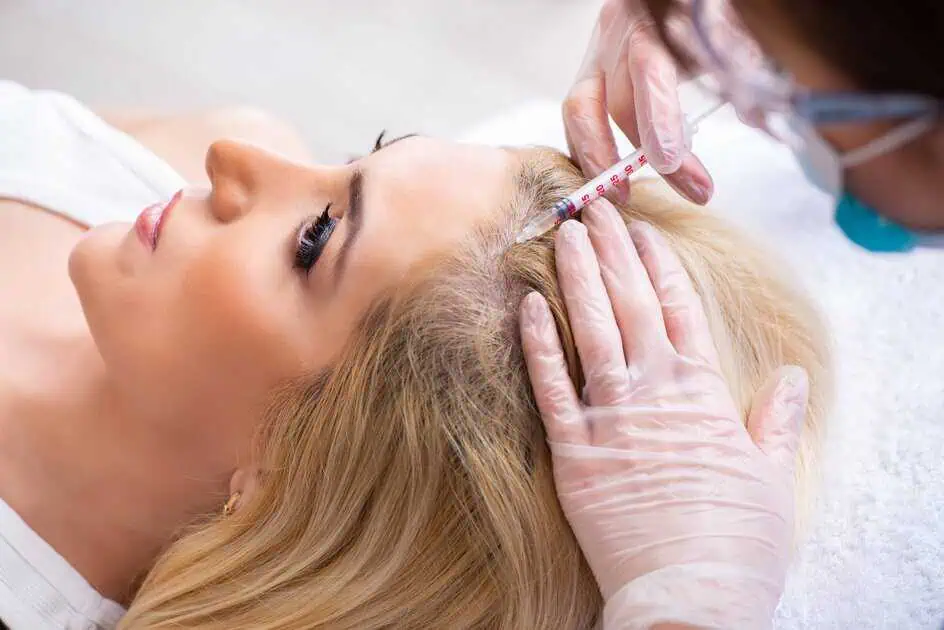 Hair Restoration in san angelo tx by Beauty Abound Aesthetics
