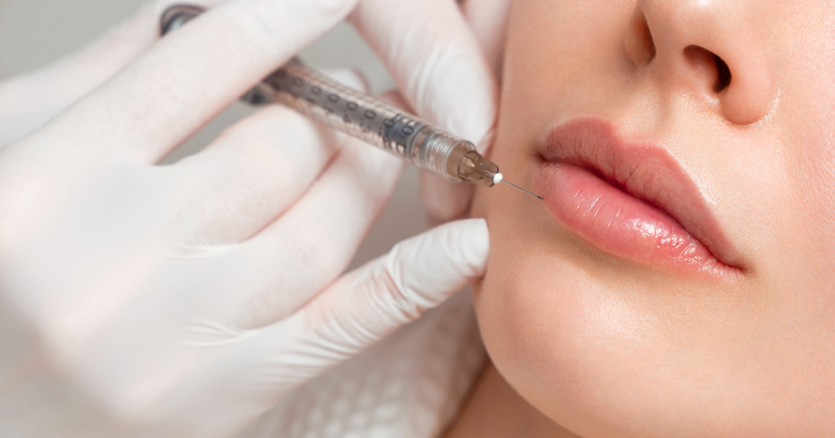 Women receiving Lip Fillers treatment in San Angelo, TX