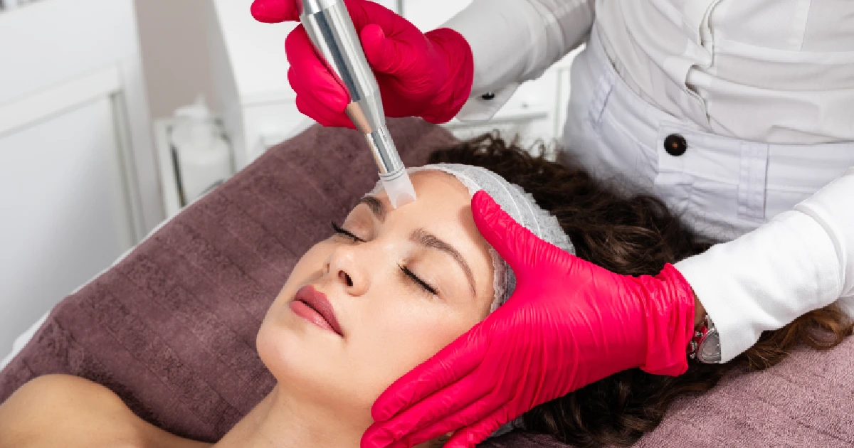 Women Receiving Microneedling Treatment in san angelo, tx