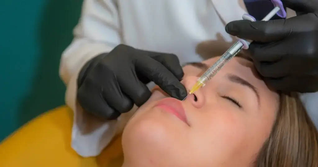 Radiesse® dermal filler treatment for facial rejuvenation, collagen stimulation, and natural-looking volume restoration.