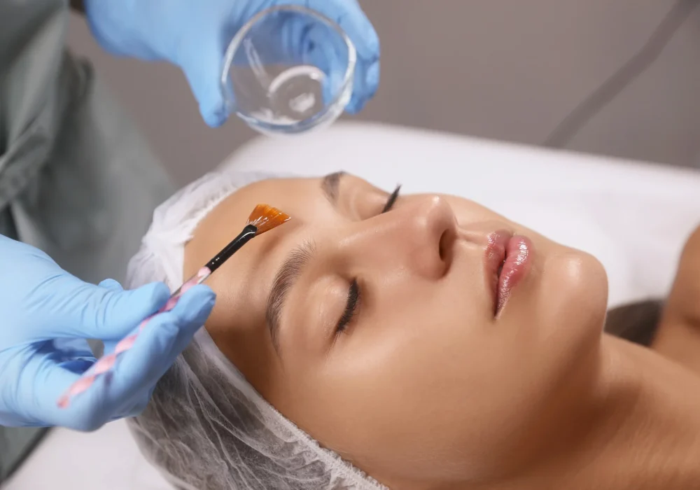 Chemical-Peel-in-Services-by-Med-Spas-Anangelo-in-San-Angelo-tx