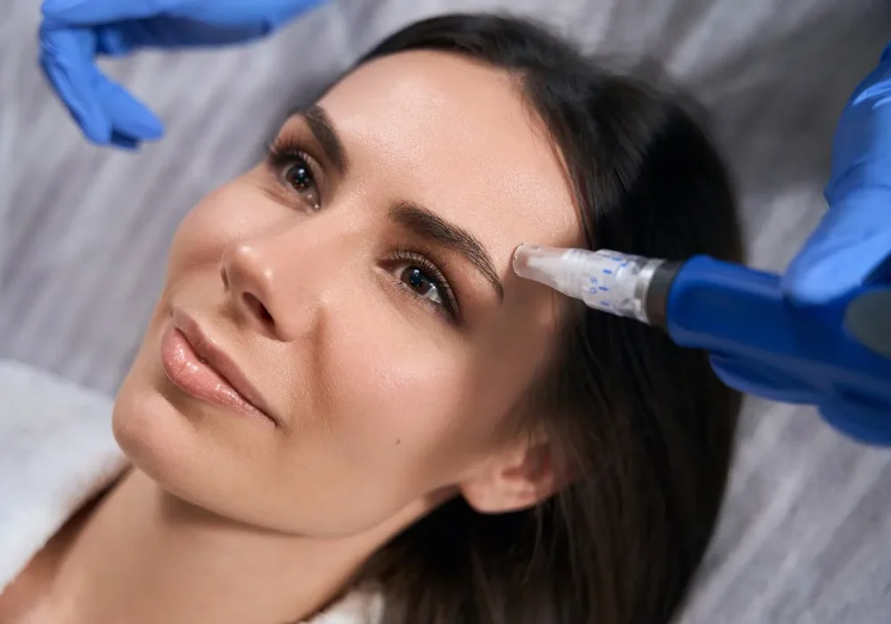 Microneedling-a-at-beauty-abound-aesthetics-llc-in-san-angelo-tx